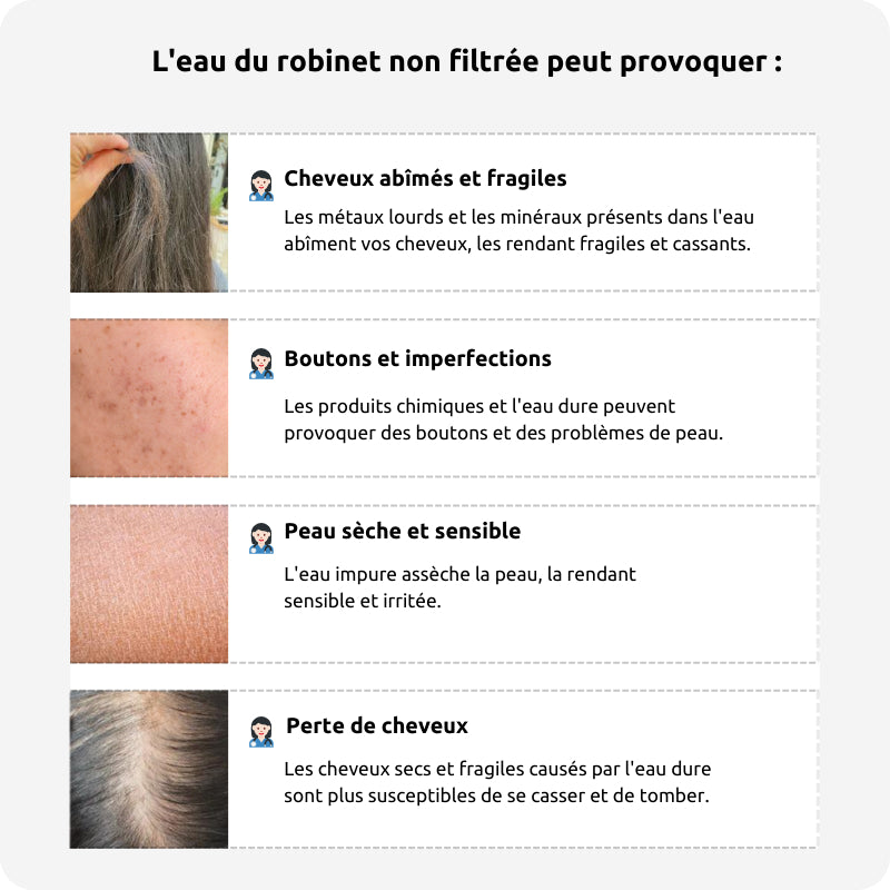 FILTRE DE DOUCHE GLOYA