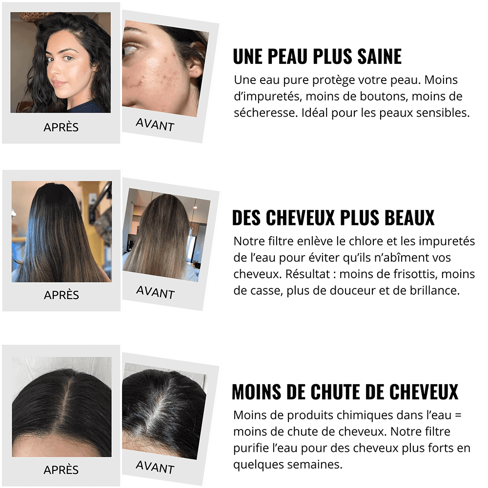 FILTRE DE DOUCHE GLOYA